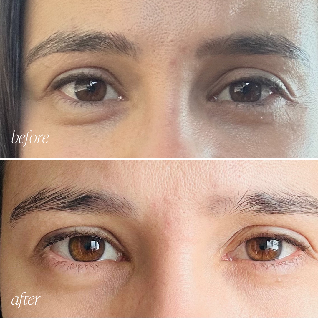 Before and after eye cream results showing reduced puffiness and brighter under-eyes in 28 days