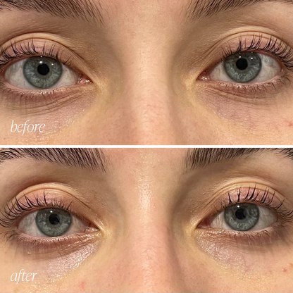 Before and after eye cream results showing reduced puffiness and brighter under-eyes in 28 days