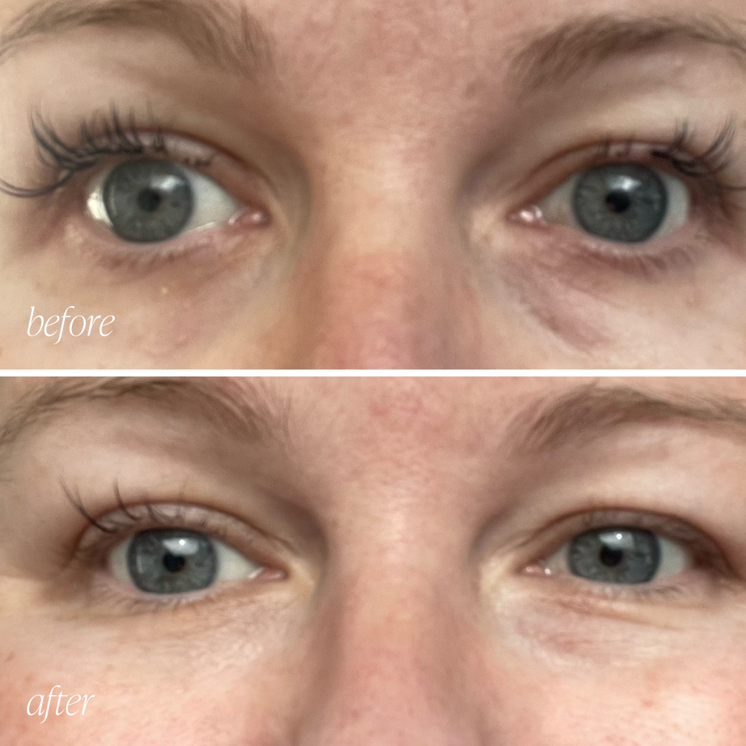 Before and after eye cream results showing reduced puffiness and brighter under-eyes in 28 days
