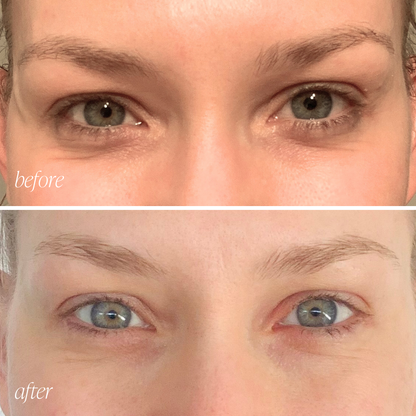 Before and after eye cream results showing reduced puffiness and brighter under-eyes in 28 days