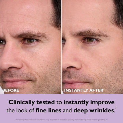 🔥BUY 1 GET 1|Instant Firm Face Tightener