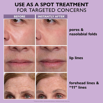🔥BUY 1 GET 1|Instant Firm Face Tightener