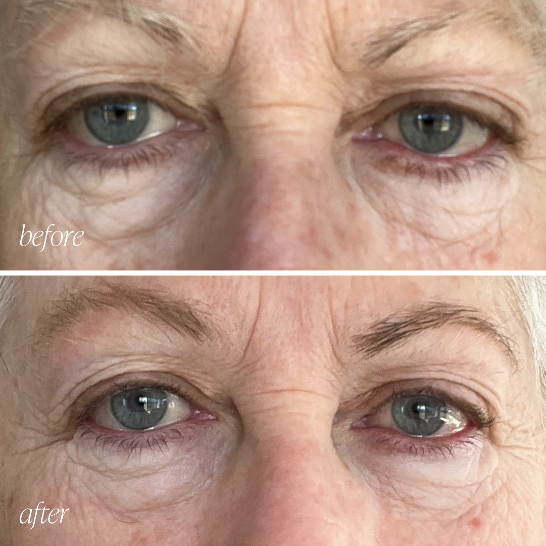 Before and after eye cream results showing reduced puffiness and brighter under-eyes in 28 days